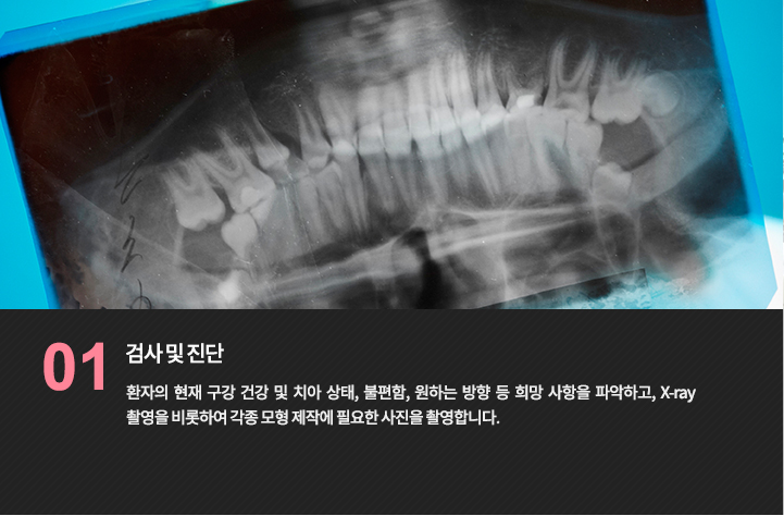 치과 영상 자료 참고 사진