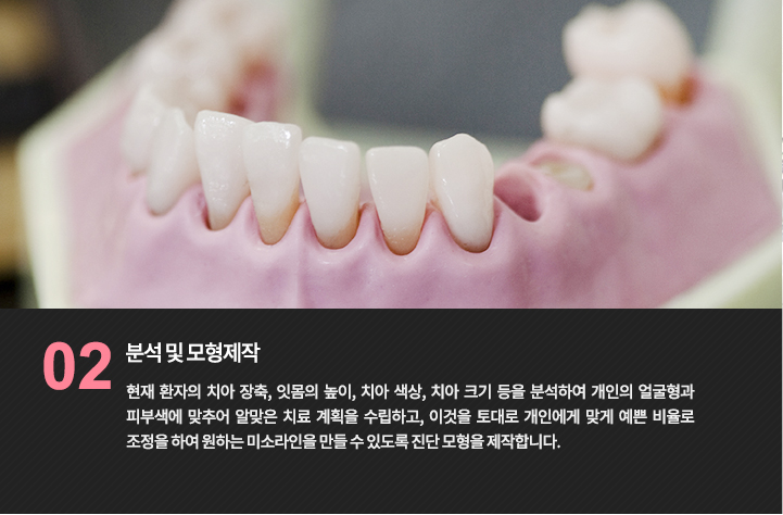 치아 모형 참고 사진