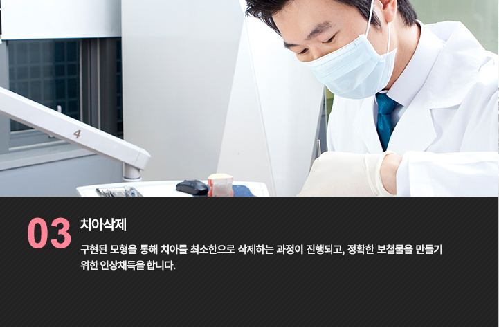 치아 준비 진료 참고 사진
