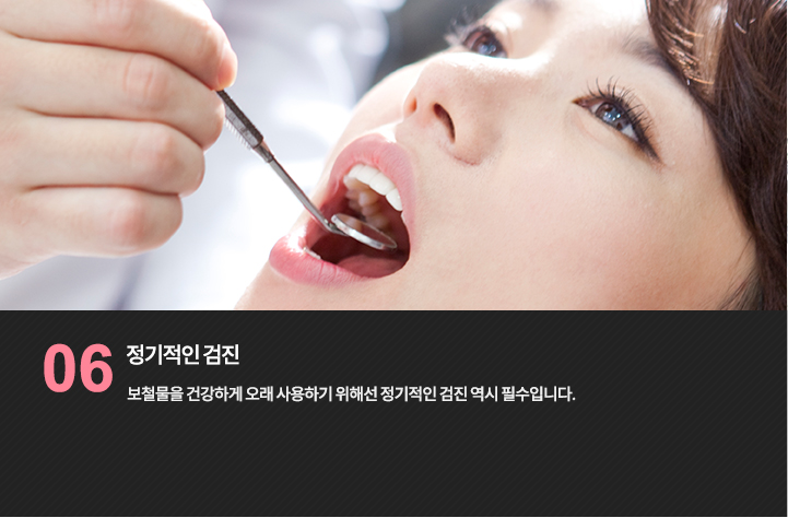 구강 검진 참고 사진