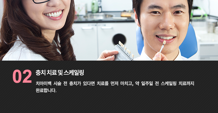치아 색상 견본으로 상담하는 참고 사진