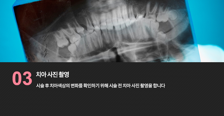 치과 영상 자료 참고 사진