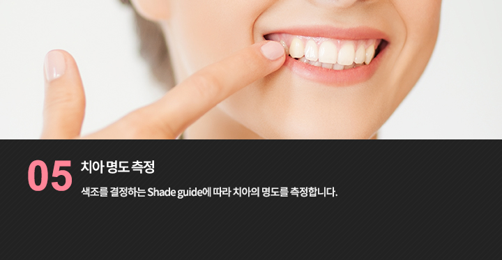 치아 밝기 확인을 설명하는 참고 사진