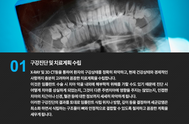 구강 진단을 설명하는 X-ray 이미지