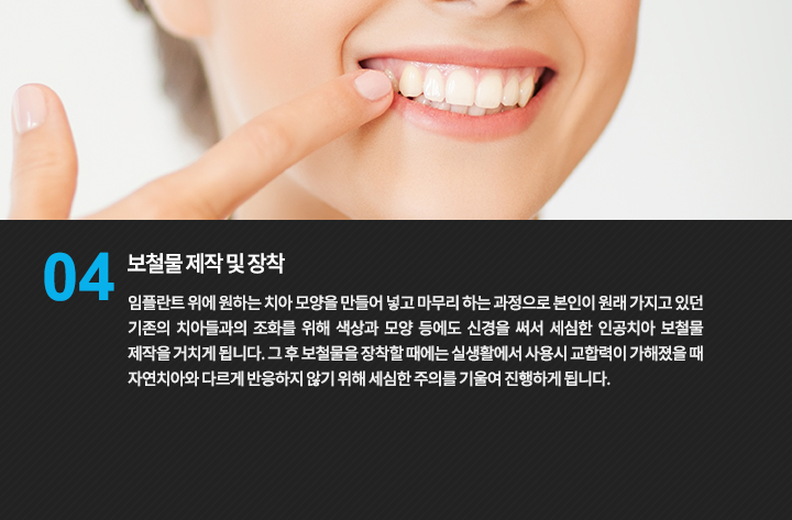 치아의 색상과 형태를 설명하는 이미지