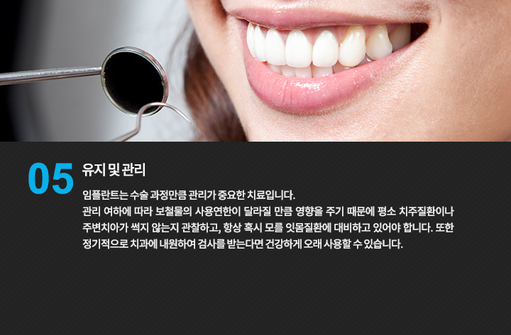 구강 검진을 설명하는 이미지