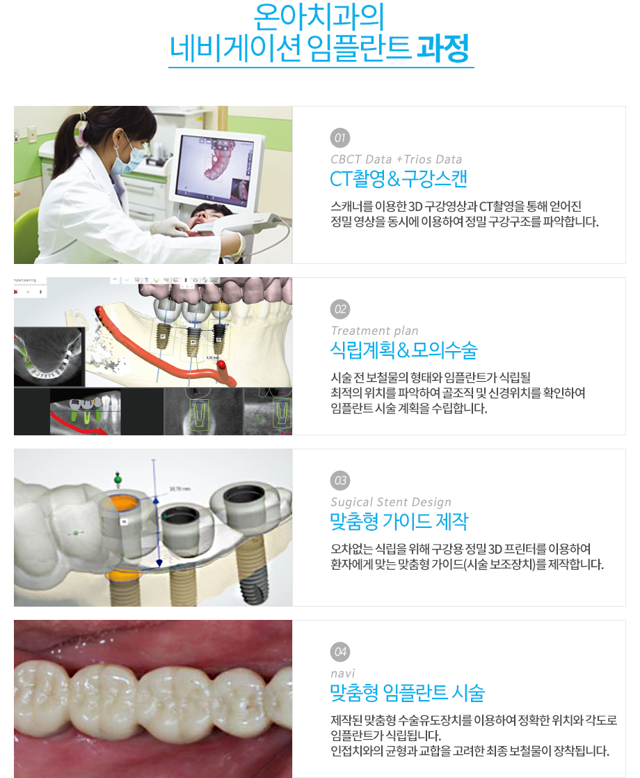 구강스캐너 사용을 설명하는 사진