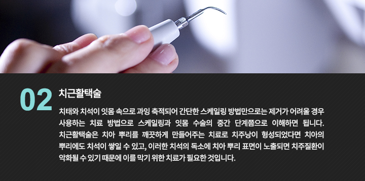 치석 제거 기구를 설명하는 사진