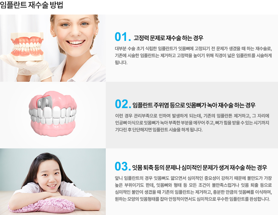 임플란트와 주변 잇몸의 관계를 보여주는 치아 모형