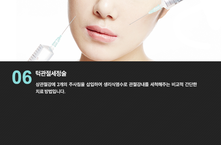 얼굴 부위 주사 관련 이미지
