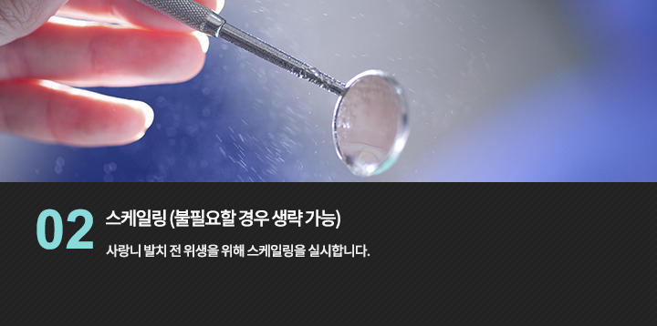치과 검사 기구 참고 사진