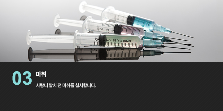 마취용 주사기 참고 사진